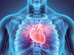 The image shows a heart beating in stress from STEMI